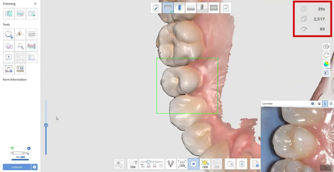ការស្កេនឌីជីថល 3D នៃធ្មេញដោយប្រើកម្មវិធី CAD នៅ Roomchang