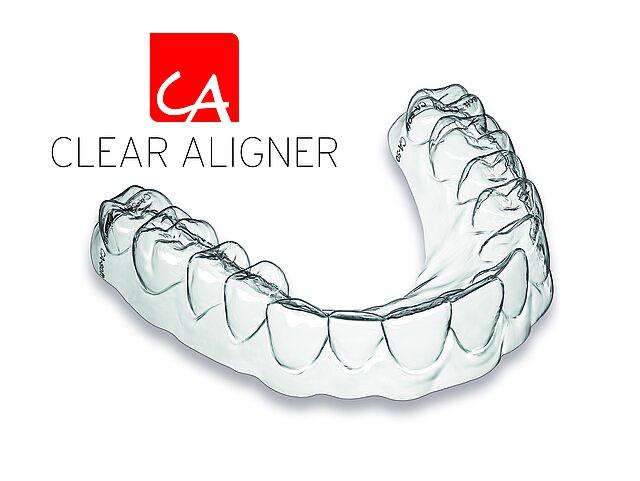Clear Aligner® (CA)
